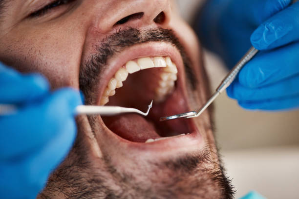 Emergency Dental Services in Slatington, PA